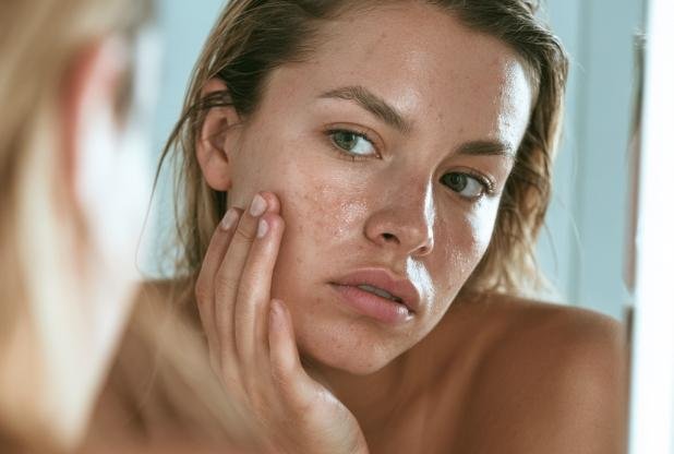 Girl with enlarged pores in Beaconsfield waiting for skin treatment with Kelly Swann