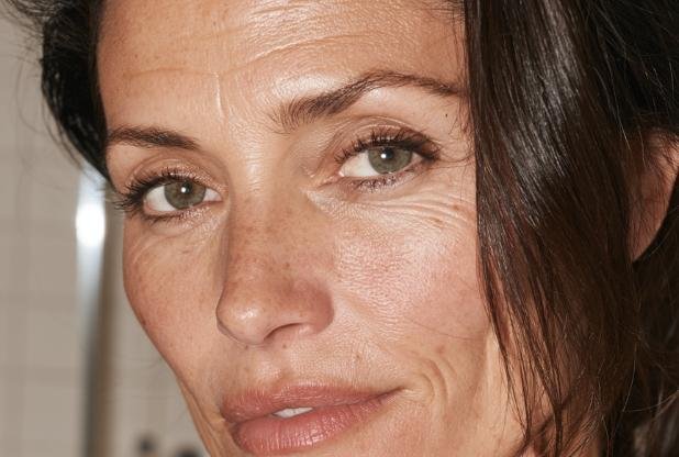 50 year old woman in Beaconsfield having finelines treatment