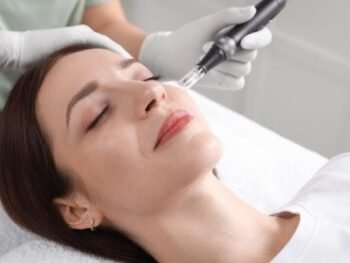 Microneedling in Beaconsfield Buckinghamshire Microneedling in Beaconsfield Buckinghamshire