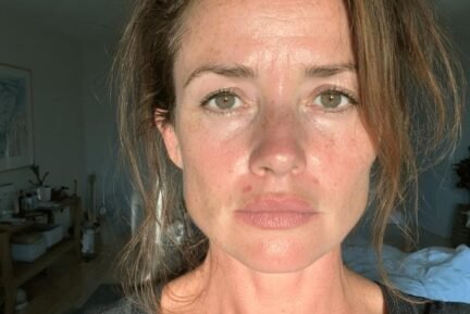 dull-tired-skin