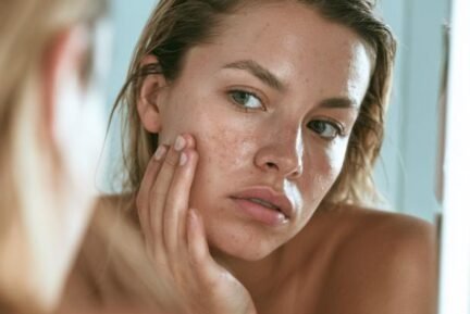 enlarged-pores Girl with enlarged pores in Beaconsfield waiting for skin treatment with Kelly Swann