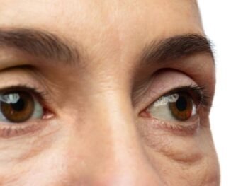 jalupro-young-eye Jalupro Young Eye Under-eye booster for puffy eyes at Sculpt in Beaconsfield